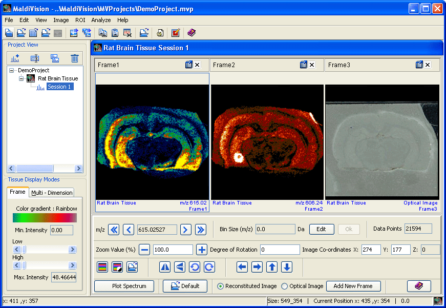 MALDIVision: Data processing